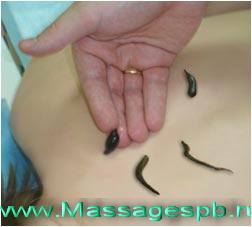 Гирудотерапия лечение пиявками на дому Петербург